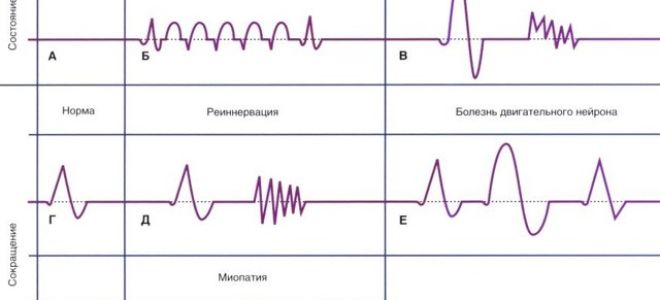 Последствия лечения дипиридамолом