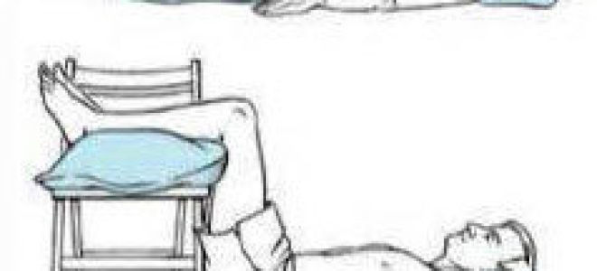 Боль в пояснице у женщин