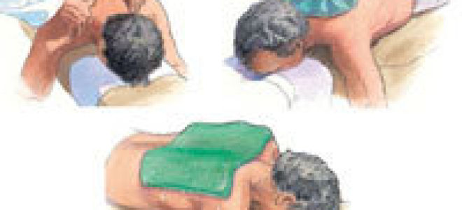 Все о головной боли напряжения (гбн)