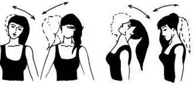 Каковы симптоматика и методы лечения лордоза?